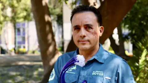 Shark Survivor: Biologist Plans to Meet His Assailant Again