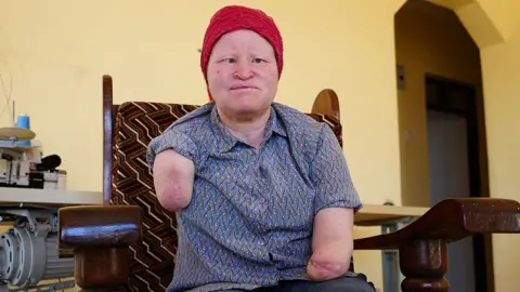 Election Terror: The Harrowing Reality of Albinism in Tanzania