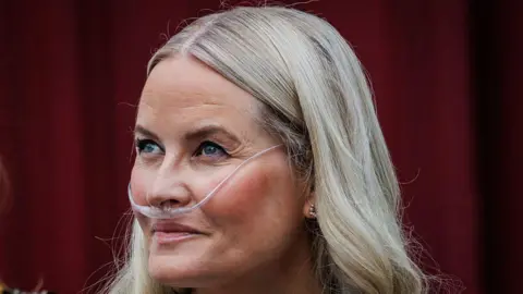 Norwegian Crown Princess Gets New Lung in Successful Transplant
